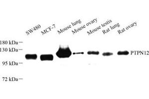 Western blot analysis of PTPN12 (ABIN7075292) at dilution of 1: 500 (PTPN12 antibody)
