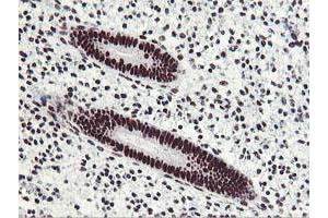Image no. 1 for anti-Homeobox C11 (HOXC11) (AA 1-304) antibody (ABIN1490736)
