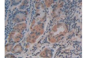 Detection of SDF1 in Human Stomach Tissue using Polyclonal Antibody to Stromal Cell Derived Factor 1 (SDF1) (CXCL12 antibody  (AA 23-89))