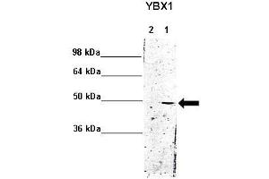 WB Suggested Anti-YBX1 Antibody    Positive Control:  Lane 1: 5ug mouse brain cytoplasm Lane 2: 5ug mouse brain nucleus   Primary Antibody Dilution :   1:1000  Secondary Antibody :  Anti rabbit - IR-dye  Secondry Antibody Dilution :   1:10,000   Submitted by:  Anonymous (YBX1 antibody  (Middle Region))