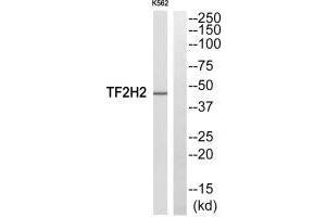 Western blot analysis of extracts from COLO205 cells, using TF2H2 antibody. (GTF2H2 antibody  (N-Term))