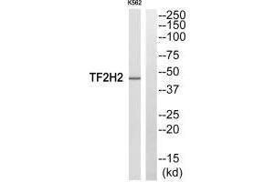 Western blot analysis of extracts from COLO205 cells, using TF2H2 antibody. (GTF2H2 antibody  (N-Term))