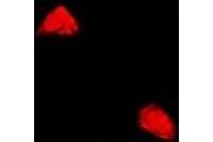 Immunofluorescent analysis of PPP2R2A staining in U2OS cells. (PPP2R2A antibody)
