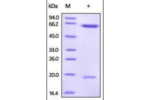 Human PCSK9 (D374Y), His Tag on SDS-PAGE under reducing (R) condition. (PCSK9 Protein (AA 31-692) (His tag))