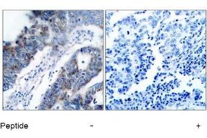 Image no. 1 for anti-Mitogen-Activated Protein Kinase Kinase Kinase 5 (MAP3K5) (Ser83) antibody (ABIN197310) (ASK1 antibody  (Ser83))