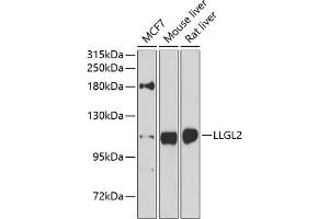 Western blot analysis of extracts of various cell lines, using LLGL2 antibody (ABIN6131794, ABIN6143262, ABIN6143265 and ABIN6224298) at 1:1000 dilution. (LLGL2 antibody  (AA 620-819))