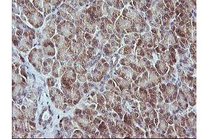Image no. 3 for anti-Mitogen-Activated Protein Kinase Kinase 3 (MAP2K3) antibody (ABIN1499399) (MAP2K3 antibody)