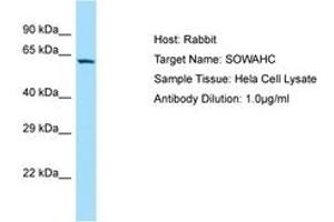 Image no. 1 for anti-Ankyrin Repeat Domain 57 (ANKRD57) (AA 128-177) antibody (ABIN6750153) (ANKRD57 antibody  (AA 128-177))