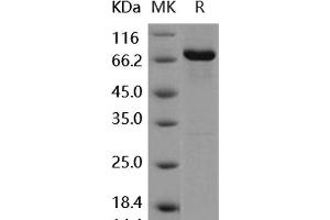 Western Blotting (WB) image for Discoidin Domain Receptor tyrosine Kinase 2 (DDR2) (Active) protein (GST tag,His tag) (ABIN7317114) (DDR2 Protein (GST tag,His tag))