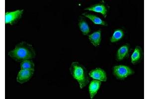 Immunofluorescent analysis of A549 cells using ABIN7159128 at dilution of 1:100 and Alexa Fluor 488-congugated AffiniPure Goat Anti-Rabbit IgG(H+L) (MED23 antibody  (AA 1014-1368))