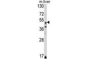 Western blot analysis of GSS Antibody (C-term) in mouse liver tissue lysates (35 µg/lane).