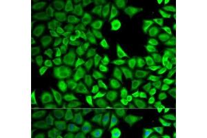 Immunofluorescence analysis of HeLa cells using LTA4H Polyclonal Antibody (LTA4H antibody)