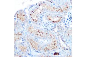 Immunohistochemistry of paraffin-embedded human esophageal using TNFSF13B Rabbit pAb (ABIN6127582, ABIN6149343, ABIN6149344 and ABIN6221563) at dilution of 1:100 (40x lens). (BAFF antibody  (AA 76-285))