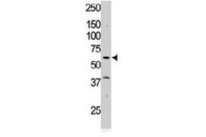 The RYK polyclonal antibody  is used in Western blot to detect RYK in Jurkat cell lysate. (RYK antibody  (AA 150-200))