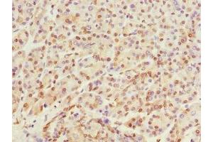 Immunohistochemistry of paraffin-embedded human pancreatic tissue using ABIN7167513 at dilution of 1:100 (PTPRO antibody  (AA 30-300))