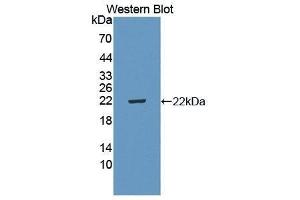 Western Blotting (WB) image for anti-Interleukin 5 Receptor, alpha (IL5RA) (AA 41-203) antibody (ABIN3206508) (IL5RA antibody  (AA 41-203))