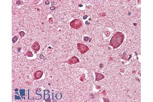 ABIN1590079 (5µg/ml) staining of paraffin embedded Human Cortex. (GABRA6 antibody  (AA 15-26))