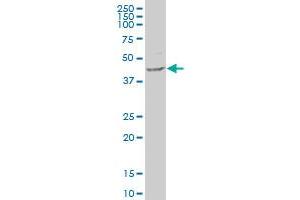 B3GNT3 polyclonal antibody (A01), Lot # 060519JCS1 Western Blot analysis of B3GNT3 expression in HeLa . (B3GNT3 antibody  (AA 135-208))