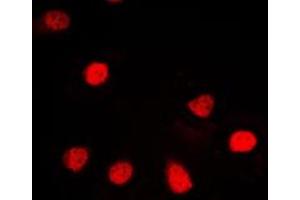 Immunofluorescent analysis of ZNF187 staining in HL60 cells. (ZNF187 antibody  (Center))
