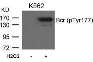 Image no. 2 for anti-Breakpoint Cluster Region (BCR) (pTyr177) antibody (ABIN196939) (BCR antibody  (pTyr177))