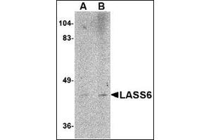 Western blot analysis of LASS6 in rat brain tissue lysate AP30493PU-N at (A) 1 and (B) 2 μg/ml. (CERS6 antibody  (N-Term))
