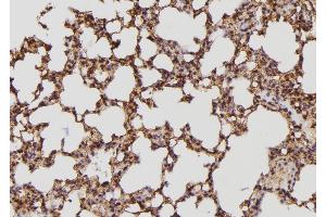 ABIN6274127 at 1/100 staining Mouse lung tissue by IHC-P. (BCAR3 antibody  (C-Term))