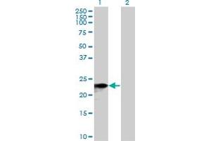 Western Blot analysis of SNX10 expression in transfected 293T cell line by SNX10 MaxPab polyclonal antibody. (SNX10 antibody  (AA 1-201))