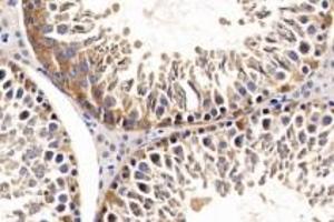 Immunohistochemistry analysis of paraffin-embedded Rat testis using ACE (ABIN7073050) at dilution of 1: 500 (Angiotensin Converting Enzyme 1 antibody)