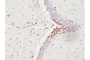 Formalin-fixed and paraffin embedded rat brain labeled with Anti-ATF6 Polyclonal Antibody, unconjugated (ABIN732293) followed by incubation with conjugated secondary antibody and DAB staining (ATF6 antibody  (AA 301-400))