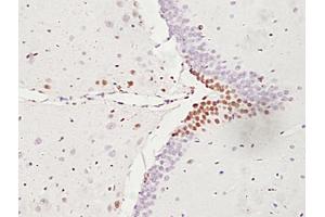 Formalin-fixed and paraffin embedded rat brain labeled with Anti-ATF6 Polyclonal Antibody, unconjugated (ABIN732293) followed by incubation with conjugated secondary antibody and DAB staining (ATF6 antibody  (AA 301-400))