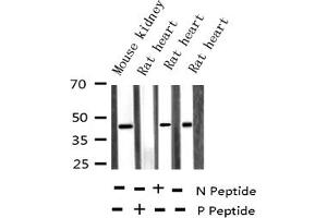 Western blot analysis of Phospho-MKK3 (Ser189) expression in various lysates (MAP2K3 antibody  (pSer189))
