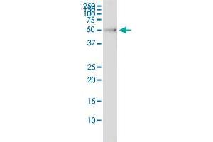 Immunoprecipitation of RP6-213H19. (RP6-213H19.1 (Human) IP-WB Antibody Pair)