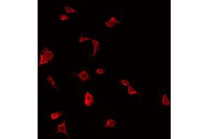 ABIN6272329 staining COLO205 by IF/ICC. (IL1RAPL2 antibody  (Internal Region))