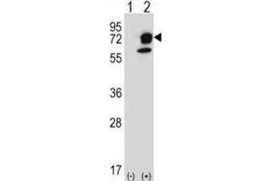 Western Blotting (WB) image for anti-Inositol-Trisphosphate 3-Kinase B (ITPKB) antibody (ABIN5024070) (ITPKB antibody)