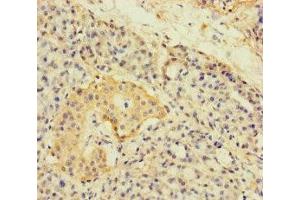 Immunohistochemistry of paraffin-embedded human pancreatic tissue using ABIN7143774 at dilution of 1:100 (A4GNT antibody  (AA 26-340))