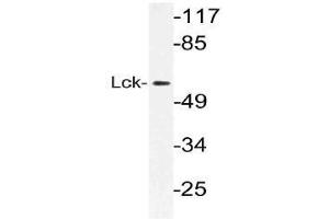 Western blot (WB) analysis of Lck antibody in extracts from Jurkat cells. (LCK antibody)