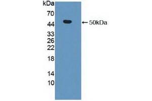 Detection of Recombinant MMP19, Human using Polyclonal Antibody to Matrix Metalloproteinase 19 (MMP19) (MMP19 antibody  (AA 98-508))