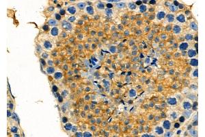 ABIN6261469 and ABIN6278061 at 1/100 staining Mouse testis tissue by IHC-P. (EHD1 antibody  (C-Term))