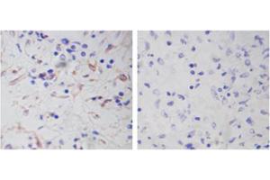 Immunohistochemistry analysis of human spleen tissue slide (Paraffin embedded) using Rabbit Anti-Vimentin Polyclonal Antibody (Left, ABIN398721) and Purified Rabbit IgG (Whole molecule) Control (Right, ABIN398653) (Vimentin antibody  (AA 400-500))