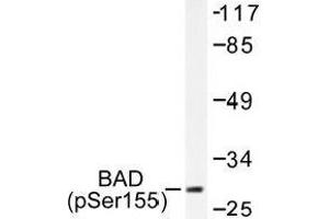 Image no. 2 for anti-BCL2-Associated Agonist of Cell Death (BAD) (pSer118), (pSer155) antibody (ABIN317970) (BAD antibody  (pSer118, pSer155))