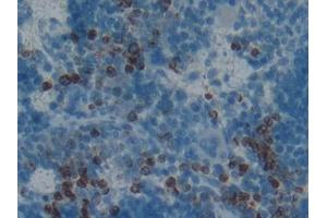 DAB staining on IHC-P; Samples: Rat Spleen Tissue (PGLYRP1 antibody  (AA 18-183))