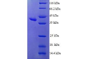Heat-Responsive Protein 12 (HRSP12) (AA 2-137) protein (GST tag)