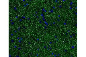 Indirect immunostaining of PFA fixed paraffin embedded mouse spinal cord section (dilution 1 : 500; green). (Alpha, beta Synuclein (AA 1-140) antibody)