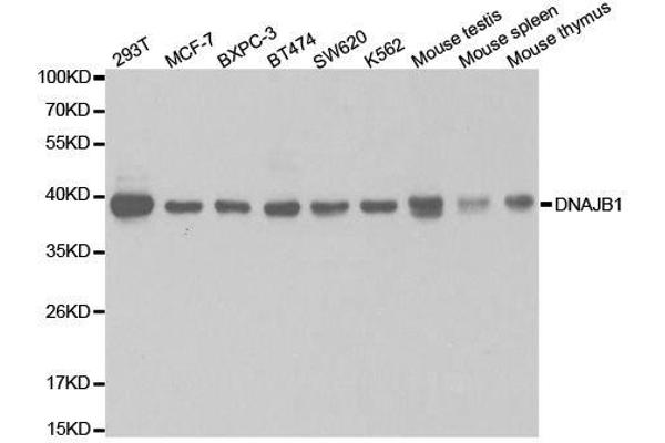 DNAJB1 抗体  (AA 1-340)