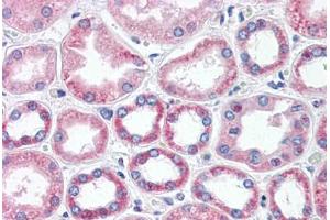 Human Kidney (formalin-fixed, paraffin-embedded) stained with BAI3 antibody ABIN462085 followed by biotinylated goat anti-rabbit IgG secondary antibody ABIN481713, alkaline phosphatase-streptavidin and chromogen. (BAI3 antibody  (AA 1506-1522))
