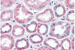 Human Kidney (formalin-fixed, paraffin-embedded) stained with BAI3 antibody ABIN462085 followed by biotinylated goat anti-rabbit IgG secondary antibody ABIN481713, alkaline phosphatase-streptavidin and chromogen.