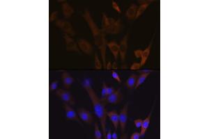 Immunofluorescence analysis of NIH-3T3 cells using  Rabbit mAb (ABIN7265739) at dilution of 1:100 (40x lens). (ABCE1 antibody)