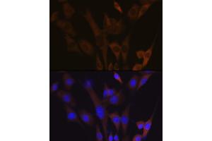 Immunofluorescence analysis of NIH-3T3 cells using  Rabbit mAb (ABIN7265739) at dilution of 1:100 (40x lens). (ABCE1 antibody)