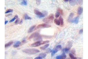 Image no. 1 for anti-Melanoma Inhibitory Activity (MIA) antibody (ABIN464852) (MIA antibody)
