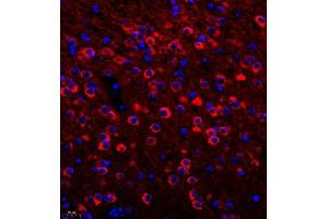 Immunofluorescence (Paraffin-embedded Sections) (IF (p)) image for anti-Dihydropyrimidinase-Like 4 (DPYSL4) antibody (ABIN7073734)